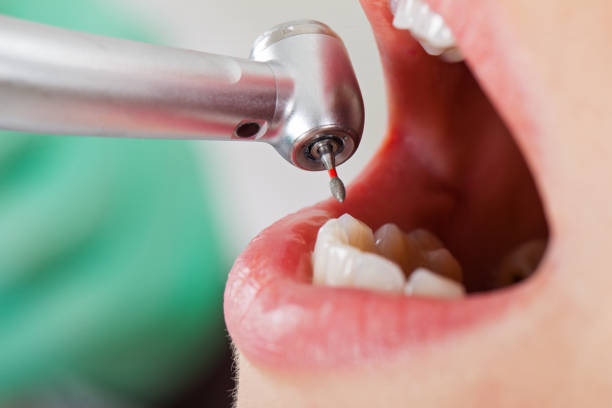 Best Emergency Dental Surgery in North Charleston, SC